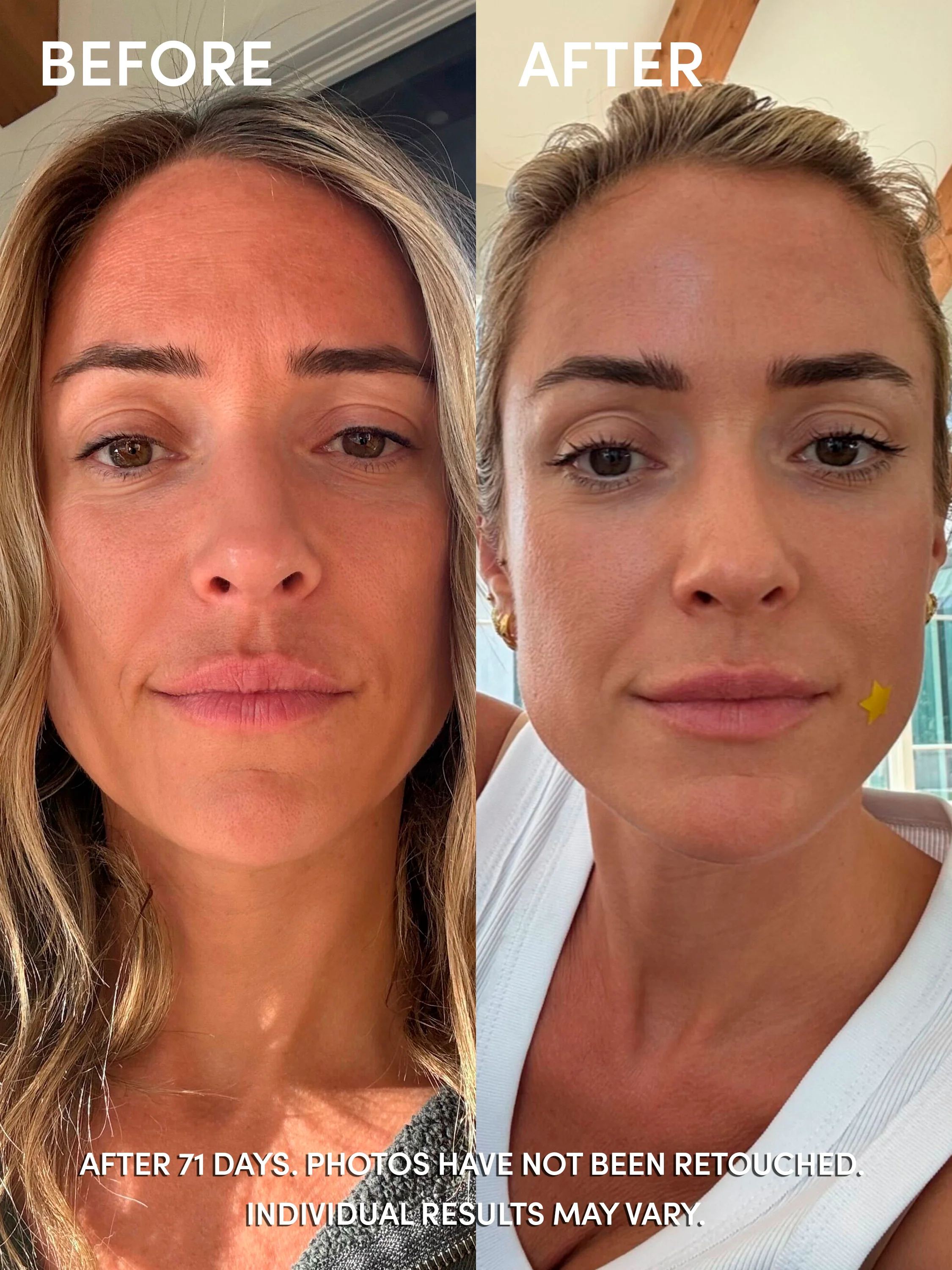 Glutathione Serum - Image 4